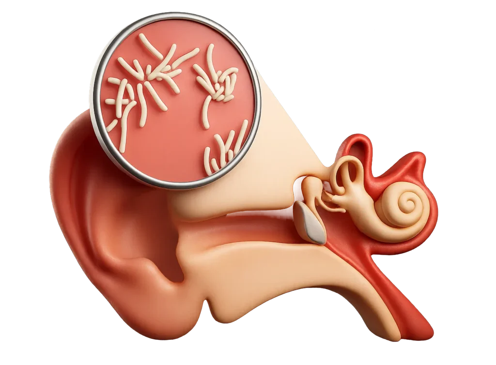 sensorineural hearing loss